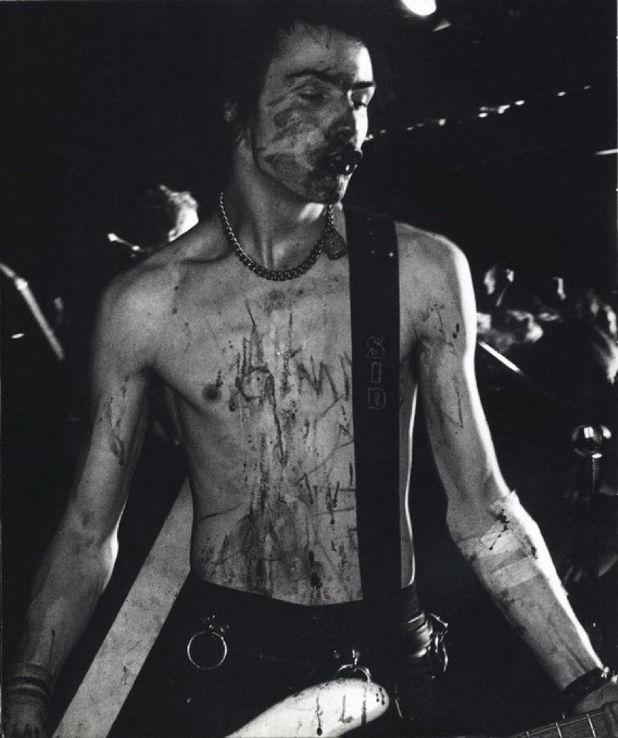 Sid Vicious Performing Cut Up and Scarred On-Stage, 1978